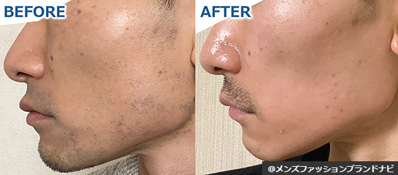 大人男性スキンケア