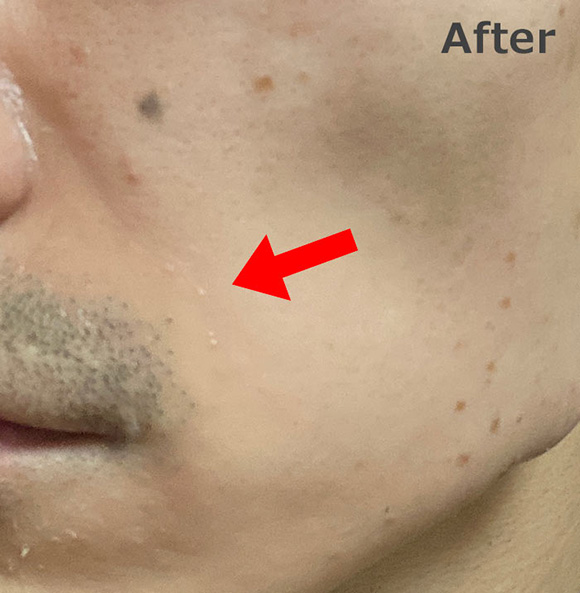 男性 リンクルショット